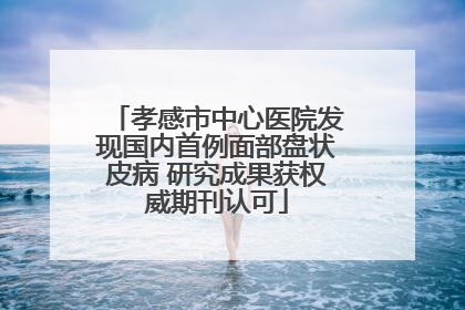 孝感市中心医院发现国内首例面部盘状皮病 研究成果获权威期刊认可
